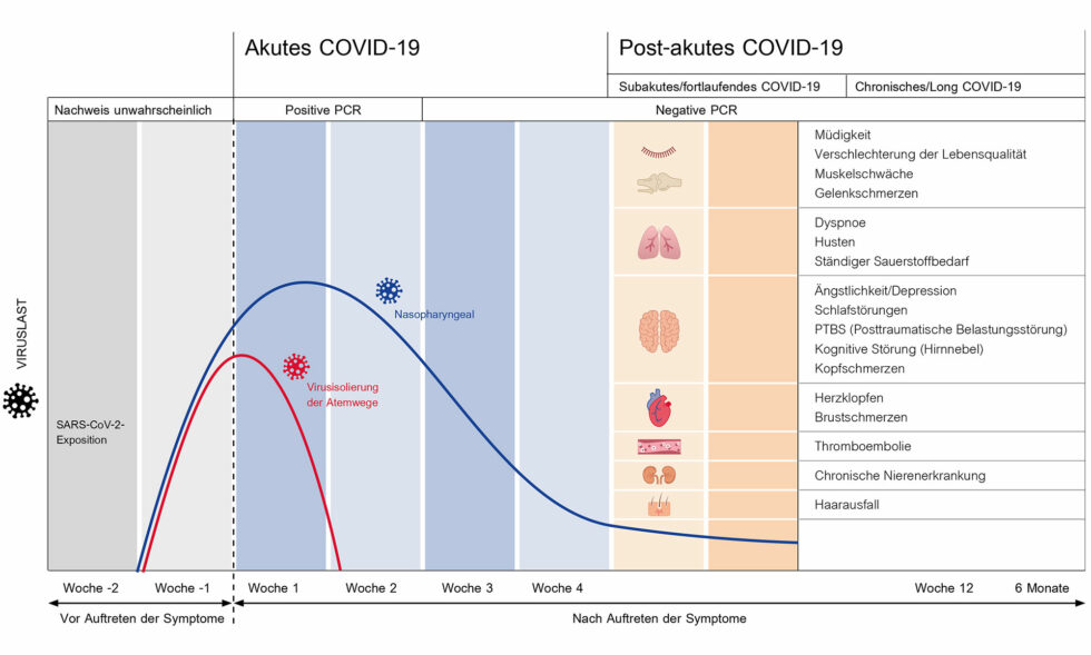 Long Covid Und Post Covid Symptome Und Therapie Cegla Medizintechnik