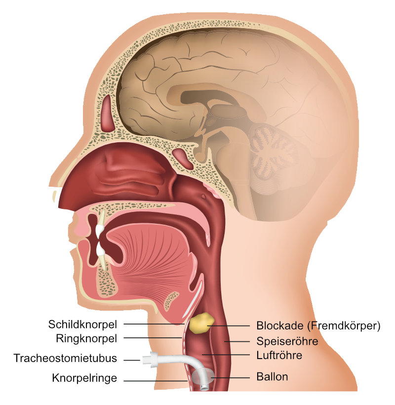 Anatomie, Diagramm, Tracheostoma