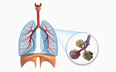 Was ist eine COPD?