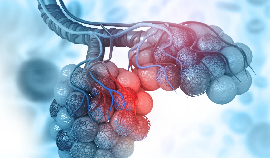 Was ist eine chronische Bronchitis?